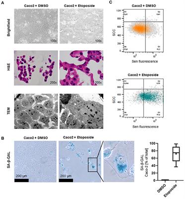 Senescence-Associated Molecules and Tumor-Immune-Interactions as Prognostic Biomarkers in Colorectal Cancer